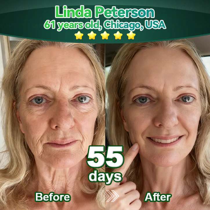 💖Change from the inside out | Purelora® Stem Cell–Derived EGF & Copper Peptide Activating Serum (Deeply activates skin renewal from within for firmer, smoother-looking skin) - Image 9